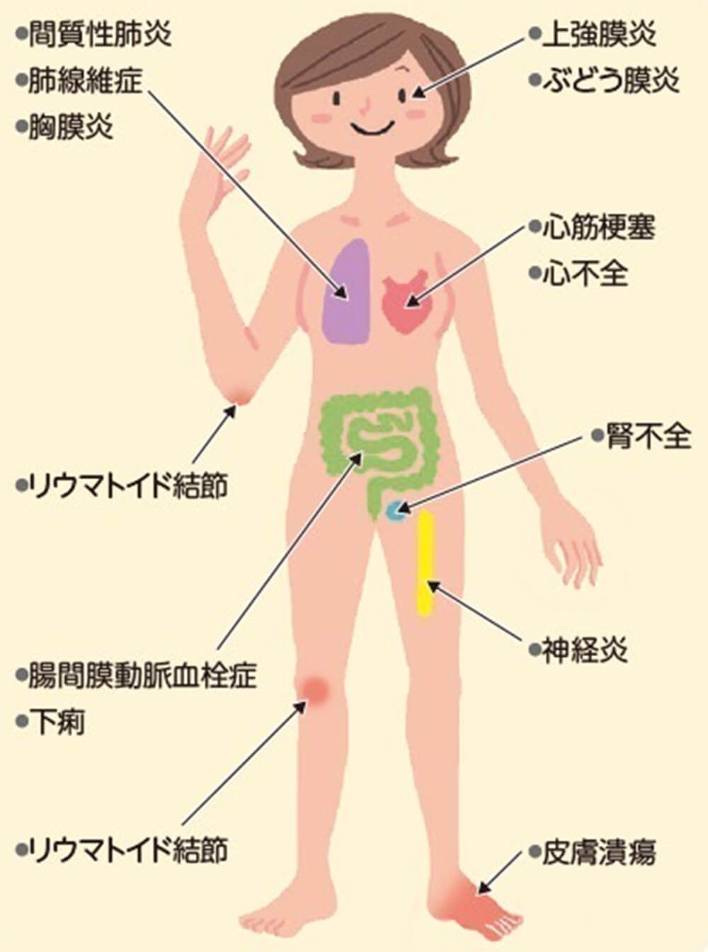 関節外症状